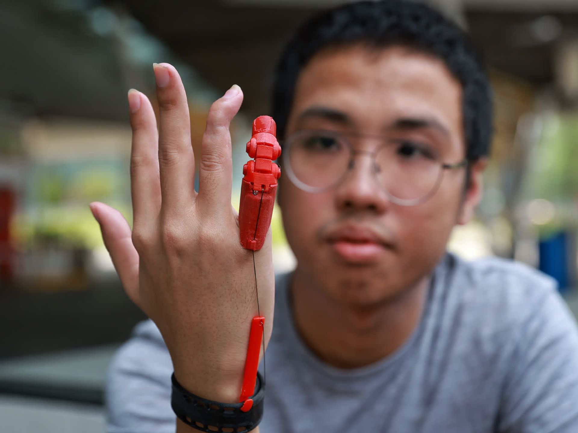 Mr Russel Ko, 21, who had his right little finger amputated after an accident, received a 3D-printed functional finger prosthesis from Tan Tock Seng Hospital that allows him to perform tasks such as opening a bottle.